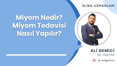 Miyom Nedir? Miyom Tedavisi Nasıl Yapılır?