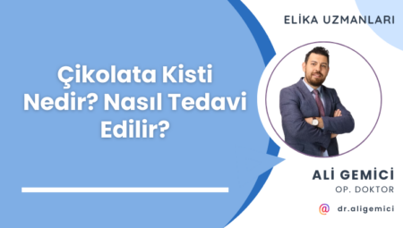 Çikolata Kisti Nedir? Nasıl Tedavi Edilir?