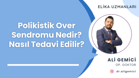 Polikistik Over Sendromu Nedir? Nasıl Tedavi Edilir?